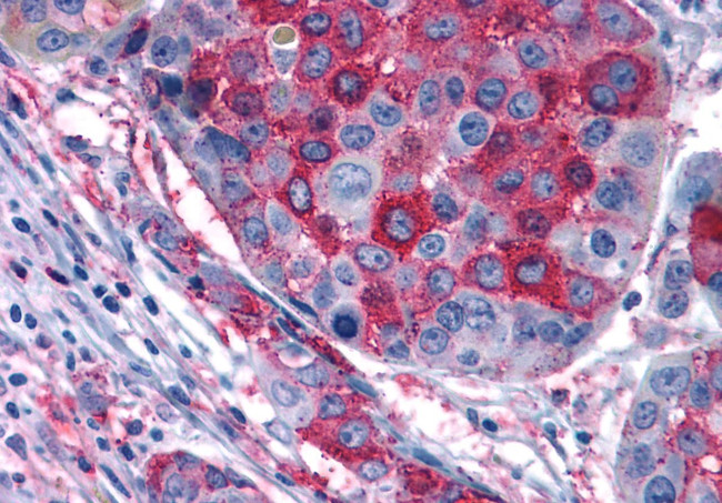 GPR108 Antibody in Immunohistochemistry (Paraffin) (IHC (P))