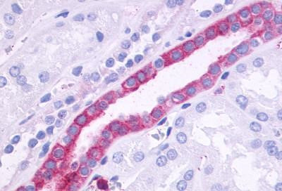 GPR110 Antibody in Immunohistochemistry (Paraffin) (IHC (P))