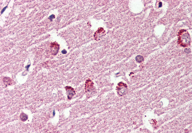 GPR119 Antibody in Immunohistochemistry (Paraffin) (IHC (P))