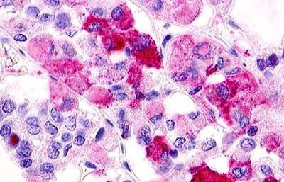 GPR12 Antibody in Immunohistochemistry (Paraffin) (IHC (P))