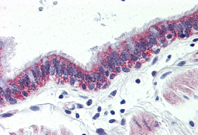 GPR126 Antibody in Immunohistochemistry (Paraffin) (IHC (P))