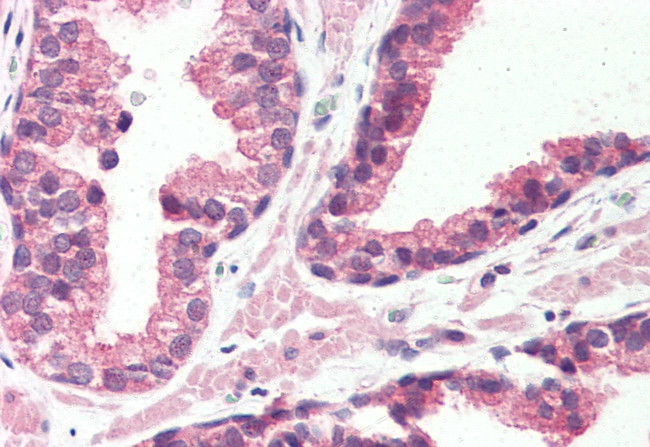 GPR126 Antibody in Immunohistochemistry (Paraffin) (IHC (P))