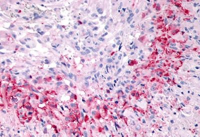 GPR133 Antibody in Immunohistochemistry (Paraffin) (IHC (P))