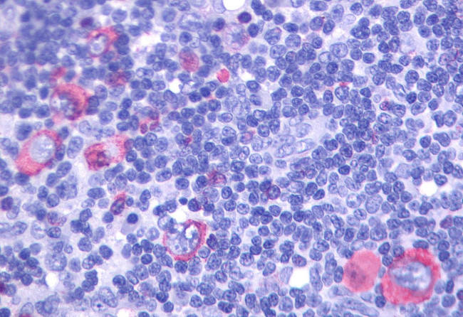 GPR137 Antibody in Immunohistochemistry (Paraffin) (IHC (P))