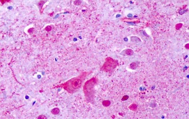 GPR137 Antibody in Immunohistochemistry (Paraffin) (IHC (P))