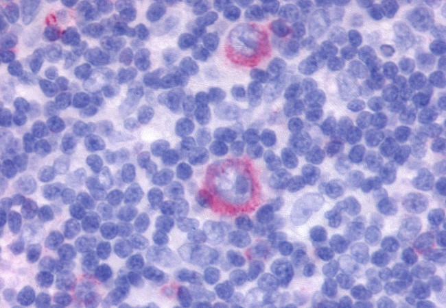 GPR137 Antibody in Immunohistochemistry (Paraffin) (IHC (P))