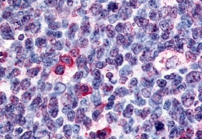 GPR146 Antibody in Immunohistochemistry (Paraffin) (IHC (P))