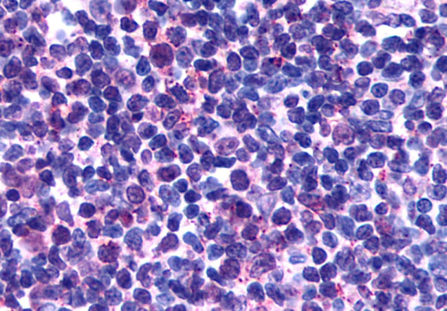 GPR146 Antibody in Immunohistochemistry (Paraffin) (IHC (P))