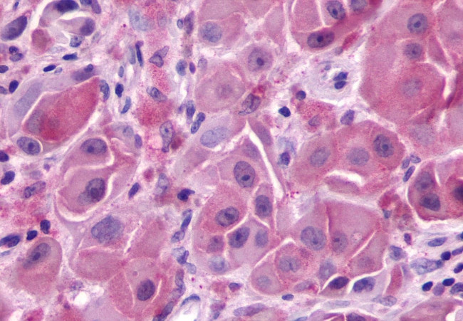 GPR148 Antibody in Immunohistochemistry (Paraffin) (IHC (P))