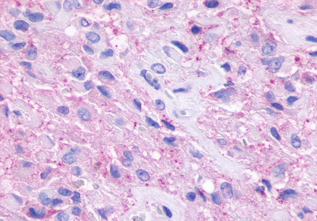 GPR148 Antibody in Immunohistochemistry (Paraffin) (IHC (P))