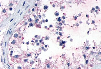 GPR149 Antibody in Immunohistochemistry (Paraffin) (IHC (P))