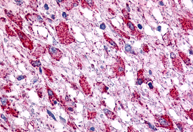GPR15 Antibody in Immunohistochemistry (Paraffin) (IHC (P))