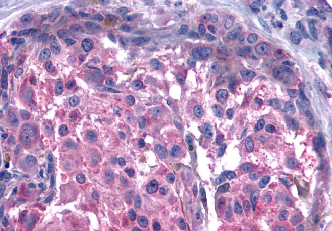 GPR15 Antibody in Immunohistochemistry (Paraffin) (IHC (P))