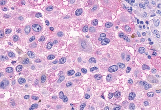 GPR150 Antibody in Immunohistochemistry (Paraffin) (IHC (P))