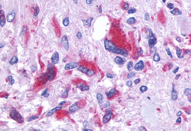 GPR150 Antibody in Immunohistochemistry (Paraffin) (IHC (P))