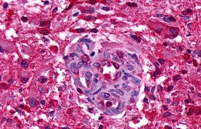 GPR151 Antibody in Immunohistochemistry (Paraffin) (IHC (P))