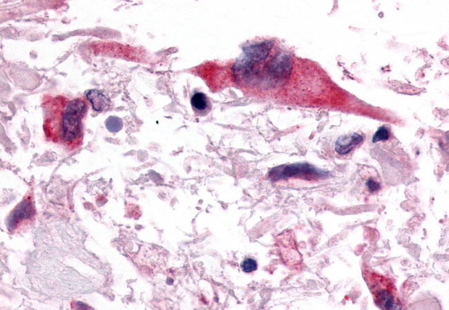 GPR153 Antibody in Immunohistochemistry (Paraffin) (IHC (P))