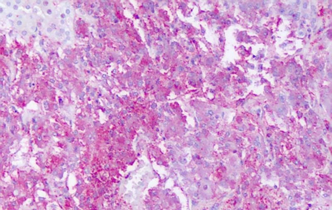 GPR161 Antibody in Immunohistochemistry (Paraffin) (IHC (P))