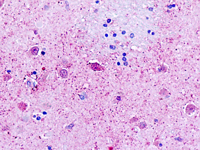 GPR162 Antibody in Immunohistochemistry (Paraffin) (IHC (P))