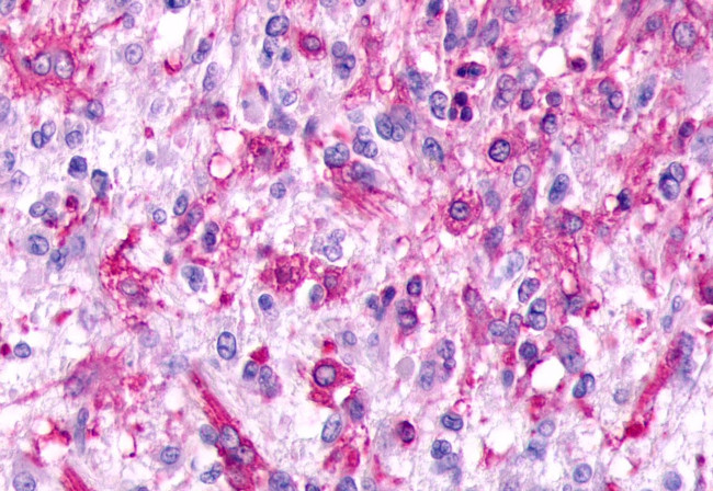 GPR17 Antibody in Immunohistochemistry (Paraffin) (IHC (P))