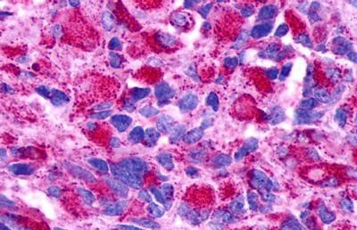 GPR174 Antibody in Immunohistochemistry (Paraffin) (IHC (P))