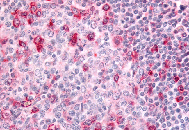 GPR183 Antibody in Immunohistochemistry (Paraffin) (IHC (P))