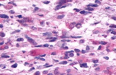 GPR19 Antibody in Immunohistochemistry (Paraffin) (IHC (P))