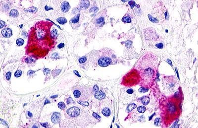 GPR21 Antibody in Immunohistochemistry (Paraffin) (IHC (P))