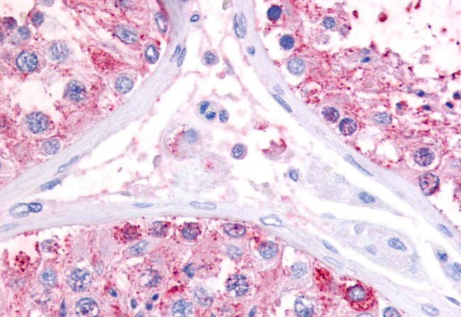GPR22 Antibody in Immunohistochemistry (Paraffin) (IHC (P))