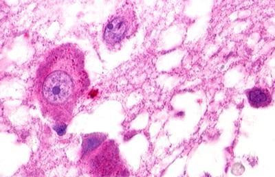 GPR25 Antibody in Immunohistochemistry (Paraffin) (IHC (P))