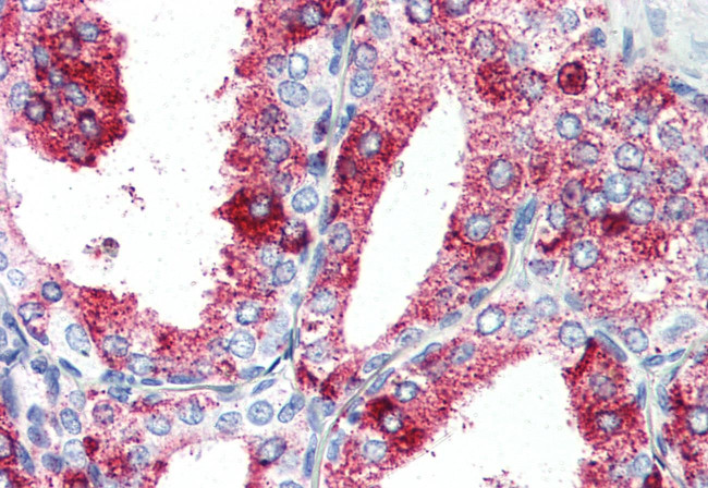 GPR27 Antibody in Immunohistochemistry (Paraffin) (IHC (P))