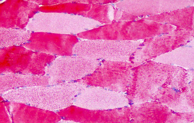 GPR30 Antibody in Immunohistochemistry (Paraffin) (IHC (P))