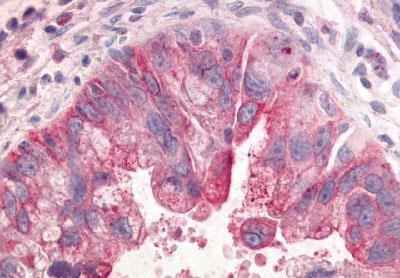 GPR31 Antibody in Immunohistochemistry (Paraffin) (IHC (P))