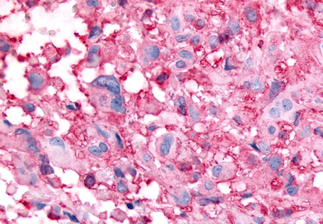 GPR32 Antibody in Immunohistochemistry (Paraffin) (IHC (P))