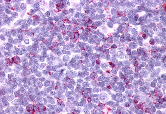 GPR34 Antibody in Immunohistochemistry (Paraffin) (IHC (P))