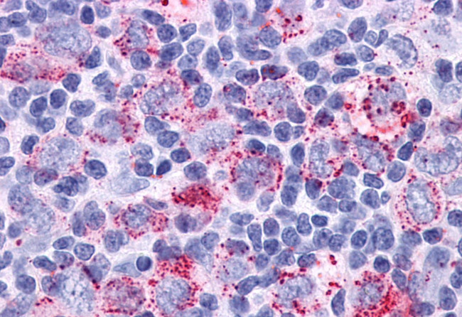 GPR34 Antibody in Immunohistochemistry (Paraffin) (IHC (P))