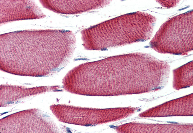 GPR43 Antibody in Immunohistochemistry (Paraffin) (IHC (P))