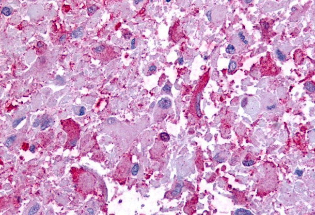 GPR45 Antibody in Immunohistochemistry (Paraffin) (IHC (P))