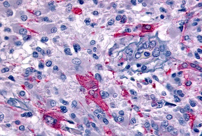 GPR45 Antibody in Immunohistochemistry (Paraffin) (IHC (P))