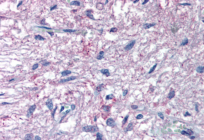 GPR50 Antibody in Immunohistochemistry (Paraffin) (IHC (P))
