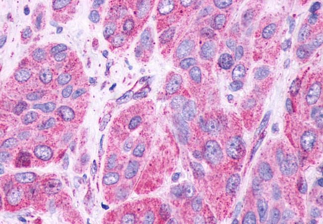 GPR61 Antibody in Immunohistochemistry (Paraffin) (IHC (P))