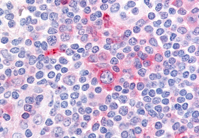 GPR62 Antibody in Immunohistochemistry (Paraffin) (IHC (P))