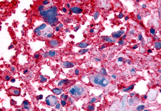 GPR63 Antibody in Immunohistochemistry (Paraffin) (IHC (P))