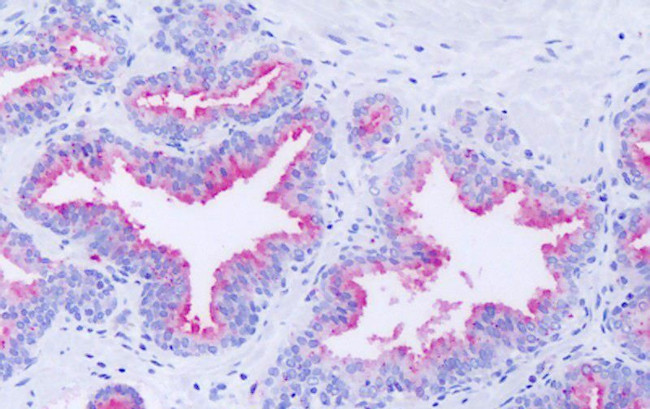 GPR63 Antibody in Immunohistochemistry (Paraffin) (IHC (P))