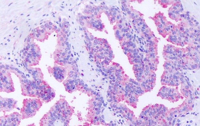 GPR63 Antibody in Immunohistochemistry (Paraffin) (IHC (P))