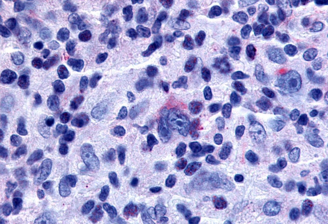 GPR65 Antibody in Immunohistochemistry (Paraffin) (IHC (P))