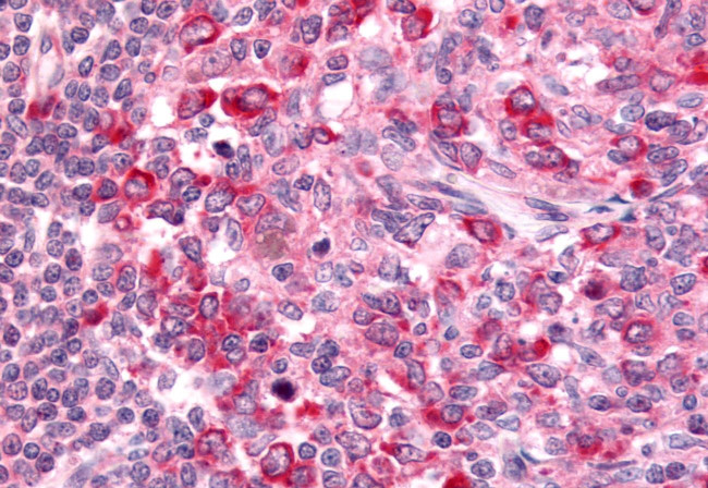 GPR65 Antibody in Immunohistochemistry (Paraffin) (IHC (P))