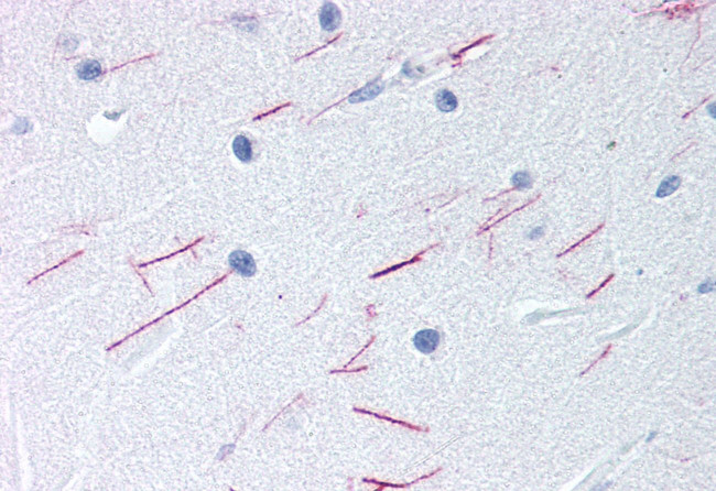 GPR68 Antibody in Immunohistochemistry (Paraffin) (IHC (P))