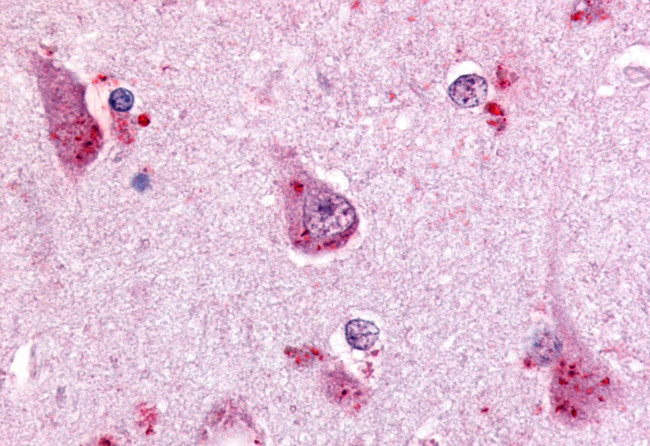 GPR68 Antibody in Immunohistochemistry (Paraffin) (IHC (P))
