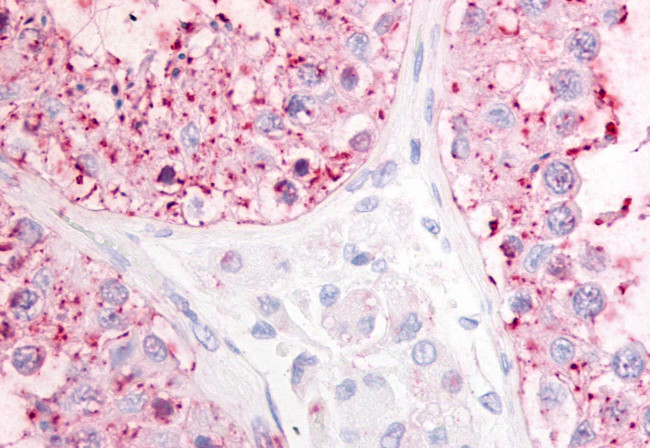 GPR68 Antibody in Immunohistochemistry (Paraffin) (IHC (P))